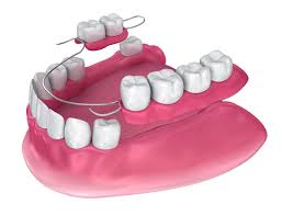 Dental Dentures SmileArt Kenya