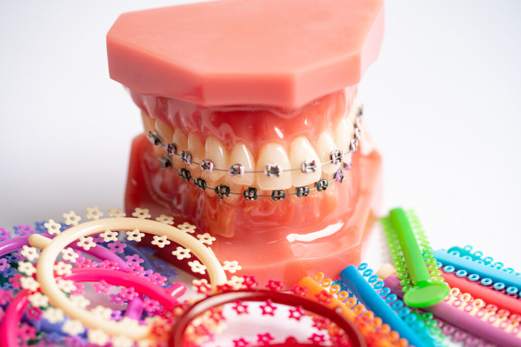 Dental Braces SmileArt Kenya