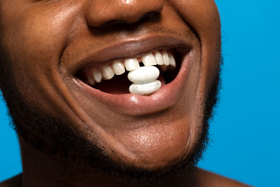 Dental-Crowns-and-Bridges--Your-Complete-Guide-to-Tooth-Restoration