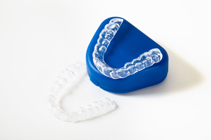 Mouthguard-SmileArt-Kenya-